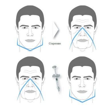 Брутальная форма наглядный пример | MEDSTYLE Алматы