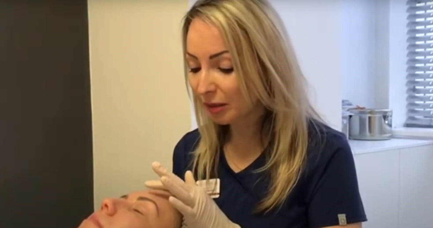 Коррекция атрофических рубцов видео процедуры | MEDSTYLE Алматы