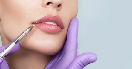 Контурная пластика губ | MEDSTYLE Алматы