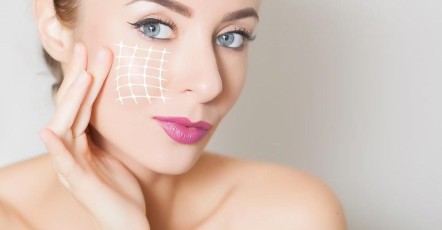 Коррекция усталого лица (щечноскуловой борозды) | MEDSTYLE Алматы