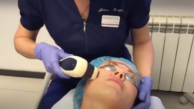 Лазерная ревитализация видео процедуры | MEDSTYLE Алматы
