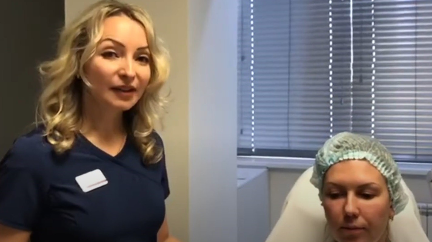 Коррекция носослезной борозды видео процедуры | MEDSTYLE Алматы