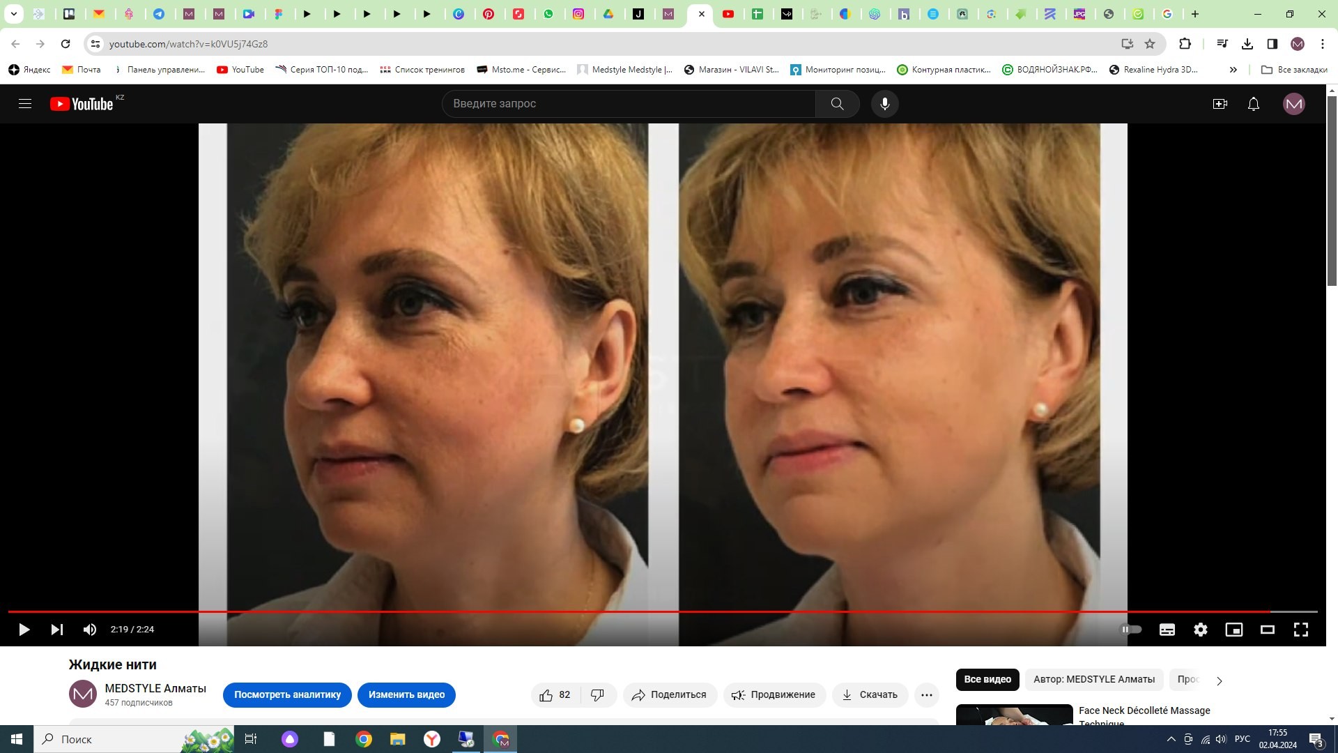 Жидкие нити видео процедуры | MEDSTYLE Алматы