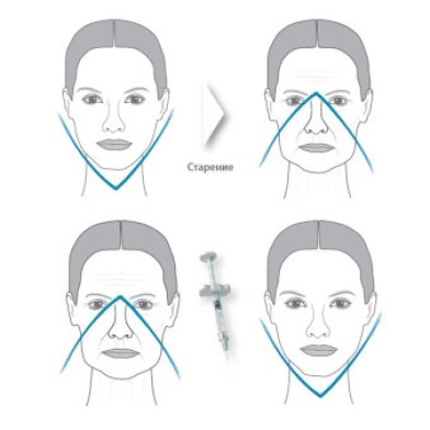 Треугольник молодости наглядный пример | MEDSTYLE Алматы