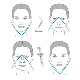 Треугольник молодости наглядный пример | MEDSTYLE Алматы