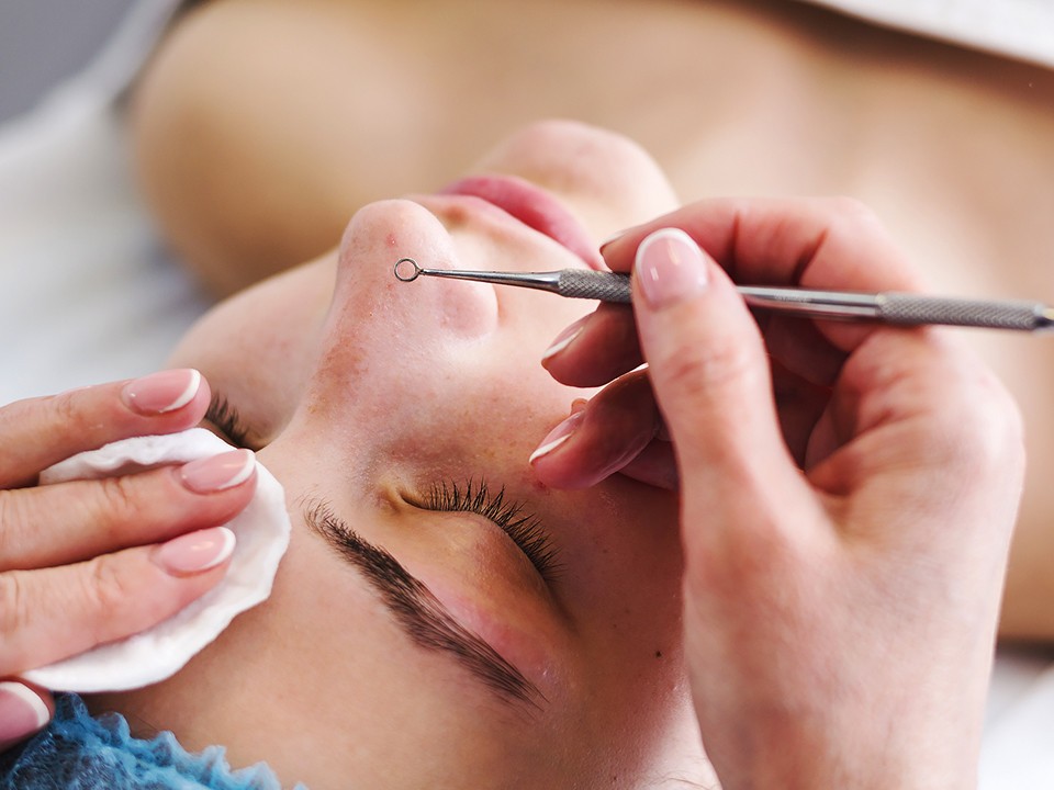 Лечение угревой сыпи Чистка  | MEDSTYLE Алматы