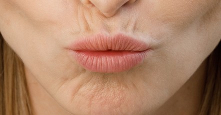 Коррекция морщин над губой | MEDSTYLE Алматы