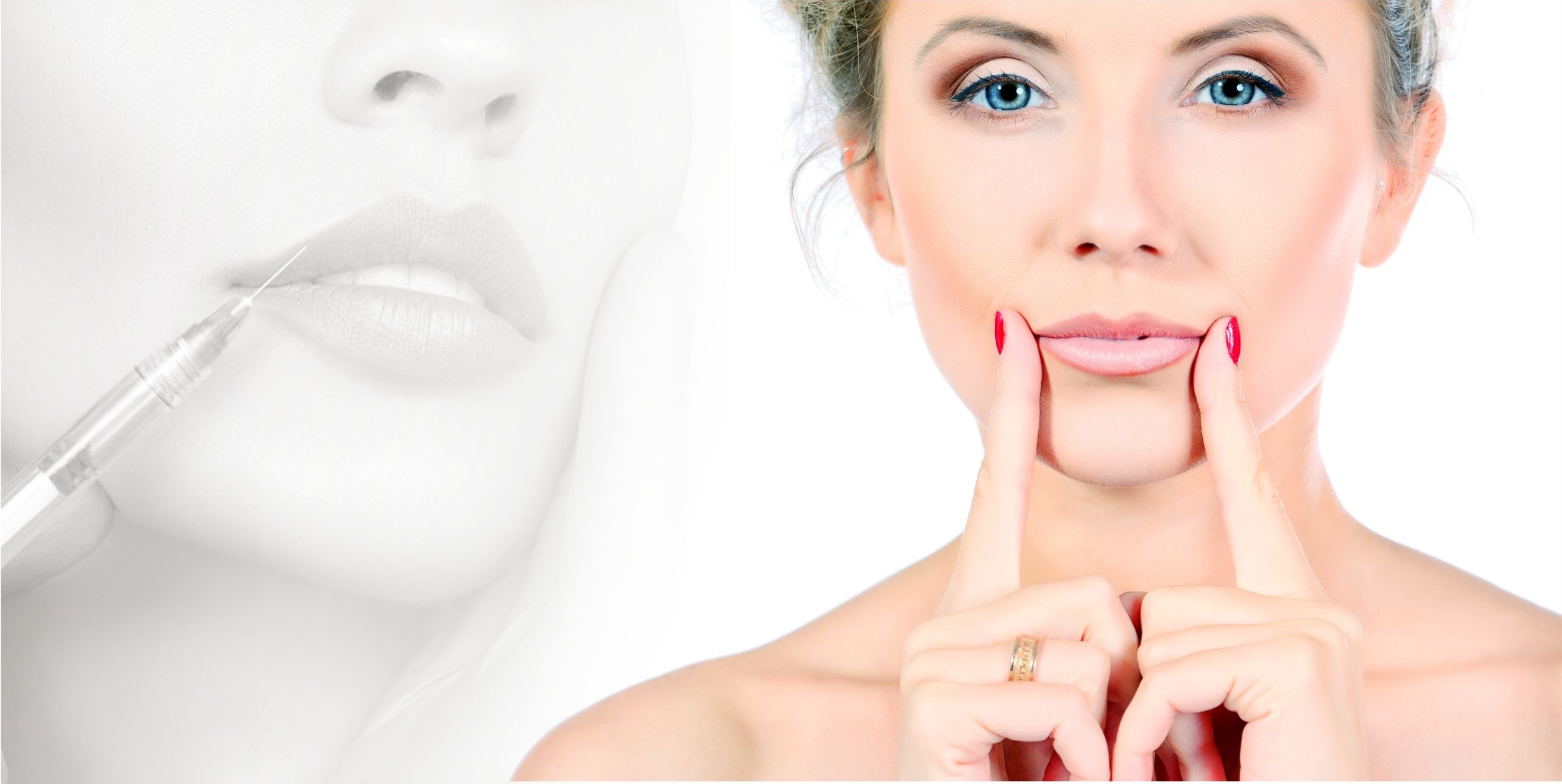 Поднятие углов рта | MEDSTYLE Алматы