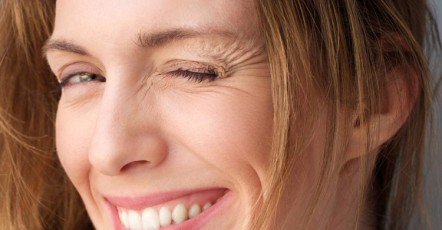 Коррекция морщин улыбки возле глаз и на щеках | MEDSTYLE Алматы