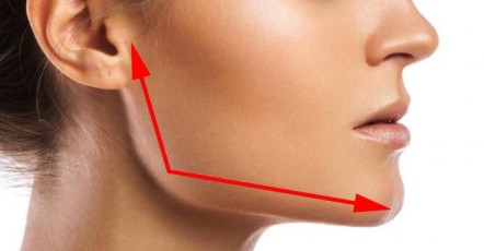 Коррекция углов челюсти | MEDSTYLE Алматы